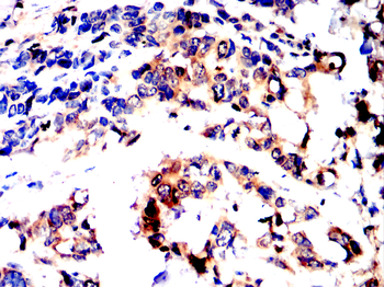 FAP Antibody