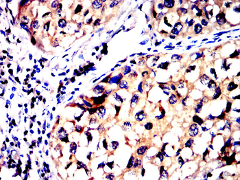 FAP Antibody