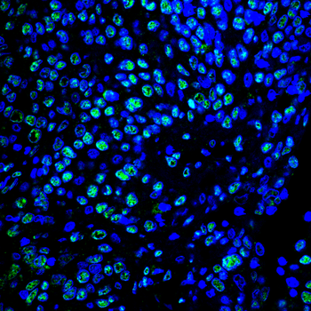 MAPK14 Antibody