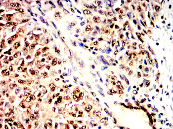 MAPK14 Antibody