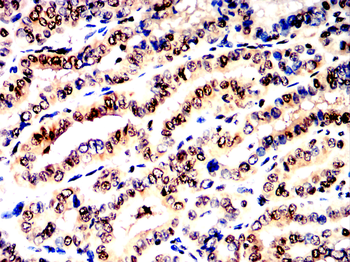 MAPK14 Antibody