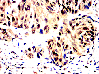 CALB2 Antibody