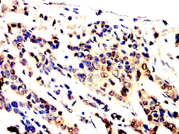 CALB2 Antibody