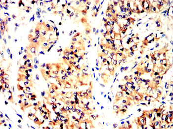 CALB2 Antibody