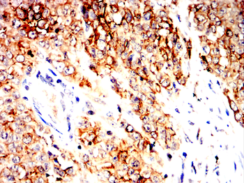 MUC1 Antibody