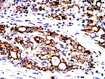 MUC1 Antibody