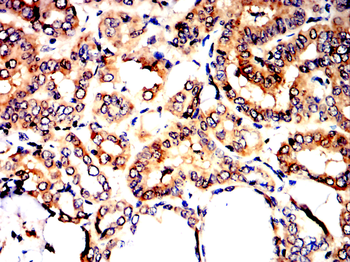 MUC1 Antibody