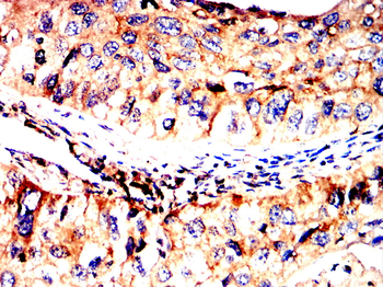 CD274 Antibody