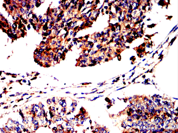 CD274 Antibody