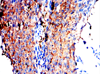 CR2 Antibody