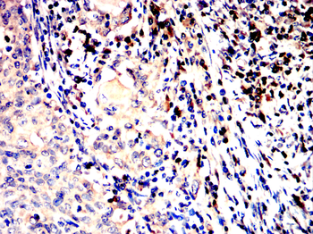CR2 Antibody
