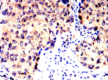CR2 Antibody