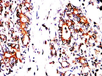 CR2 Antibody
