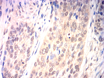 NCOR1 Antibody