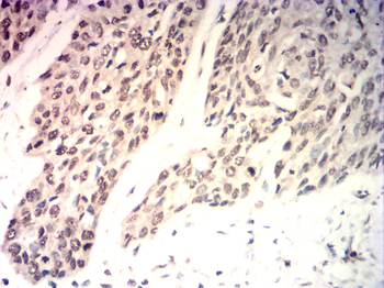 NCOR1 Antibody