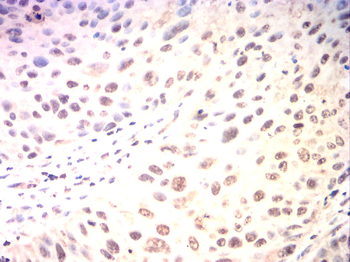 NCOR1 Antibody