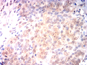NCOR1 Antibody