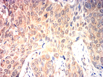 CDKN2A Antibody