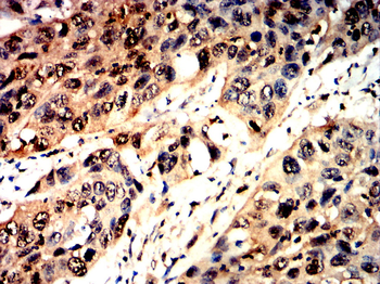 CDKN2A Antibody