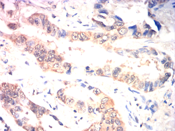 CDKN2A Antibody