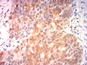 CDKN2A Antibody