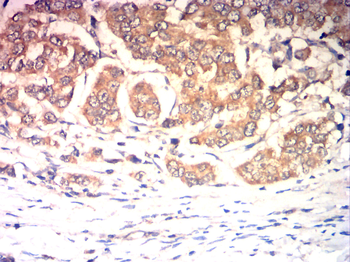 CDKN2A Antibody