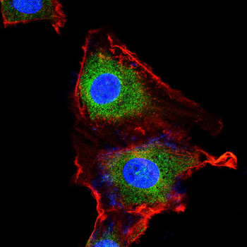 HAS2 Antibody