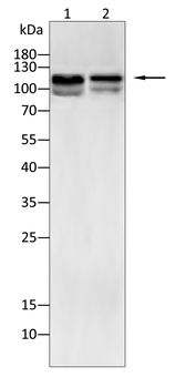HAS2 Antibody
