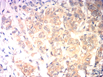 HK2 Antibody