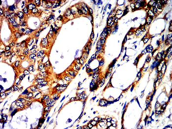 HK2 Antibody