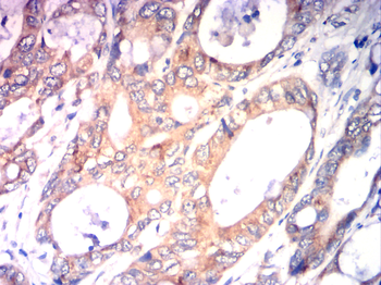 HK2 Antibody