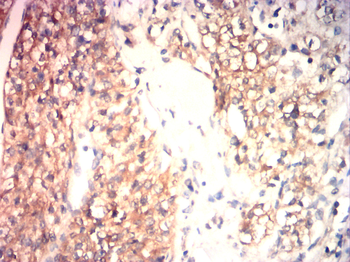 HK2 Antibody