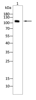 HK2 Antibody