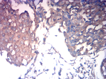 VIL1 Antibody