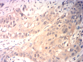 VIL1 Antibody