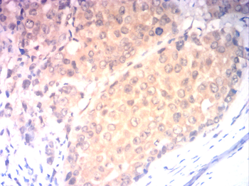 ASS1 Antibody