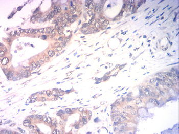 CA9 Antibody