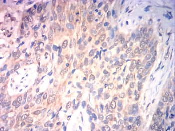 CA9 Antibody