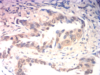 CA9 Antibody