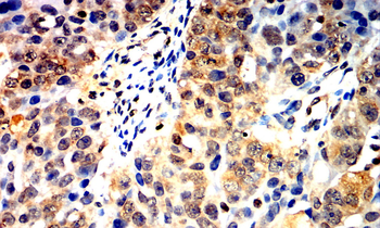 CA9 Antibody