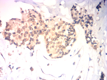 CA9 Antibody