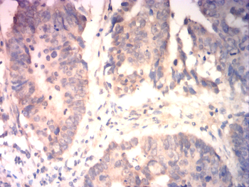 SRY Antibody