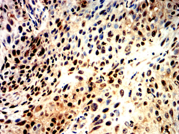 SRY Antibody