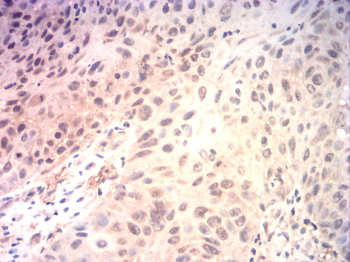 SRY Antibody