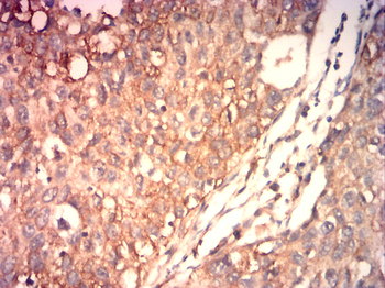 SRY Antibody