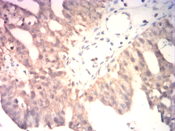 SRY Antibody