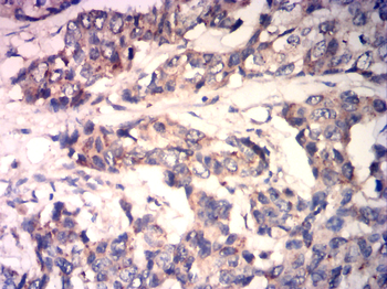 MEF2C Antibody