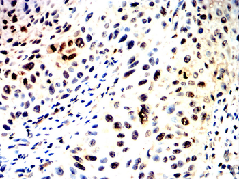 MEF2C Antibody