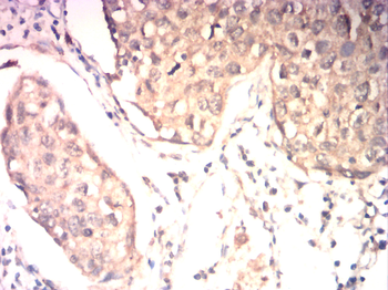 MEF2C Antibody