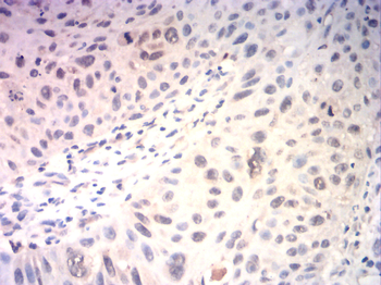 MEF2C Antibody